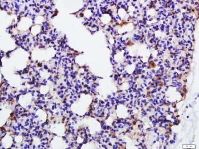 Immunohistochemical staining of Rat lung tissue using Annexin V antibody.