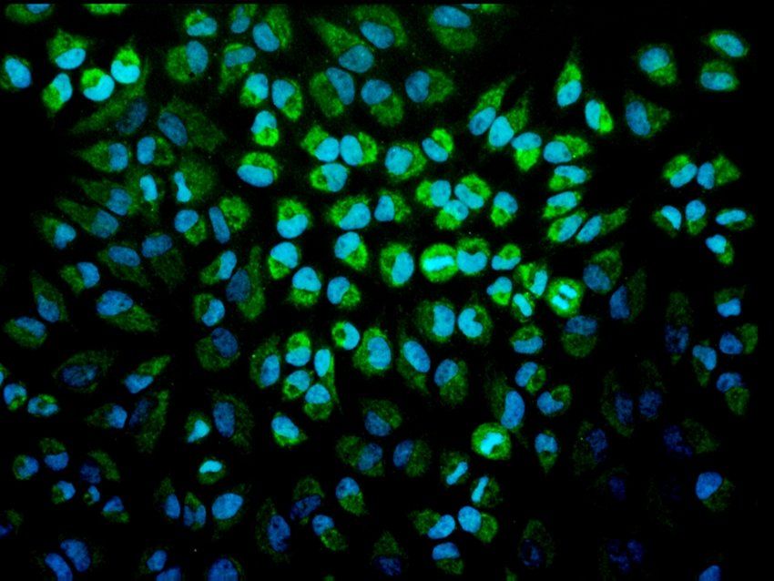Immunofluorescence analysis of hela cells using TNF-R1 antibody